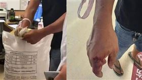 眼鏡蛇闖民宅咬傷男子，他徒手活捉裝袋就診嚇壞醫護。（圖／翻攝自微博）
