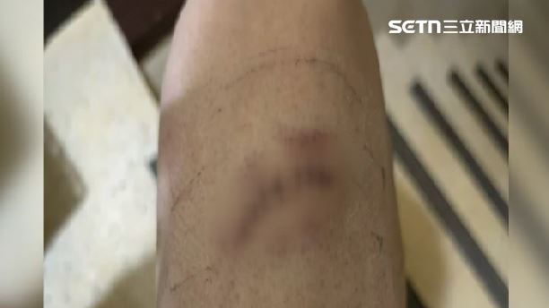 陳姓控場人員，第一時間就是他飛奔衝上前，制止許姓嫌犯，卻也送醫縫了八針 