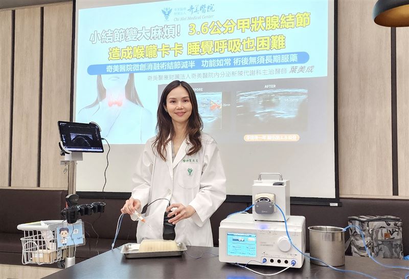 台南女甲狀腺結節「0.5cm→3.6cm」躺平出現窒息感,奇美醫微創消融。(圖/奇美醫院提供)