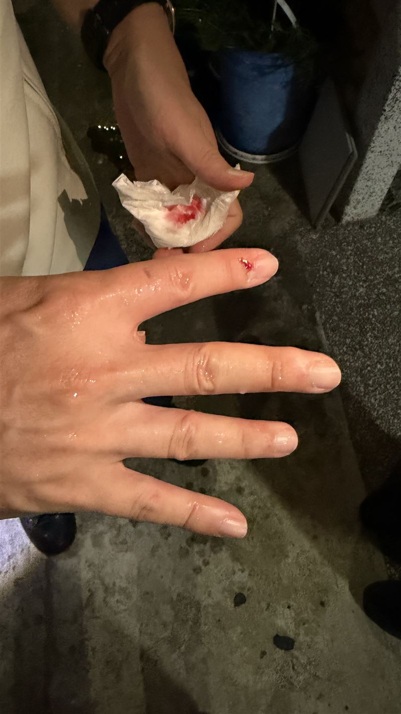 民進黨南投縣長參選人温世政昨(21)日到草屯拜票跑行程時,不慎遭犬隻咬傷手指,經過治療包紮已無大礙。(圖/溫世政競辦提供)