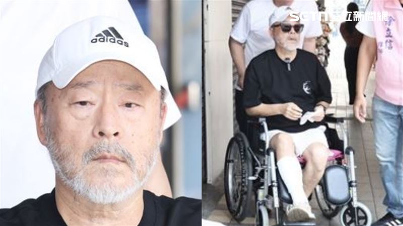 男星摔斷腿「恐難再拍戲」 律師不捨發聲