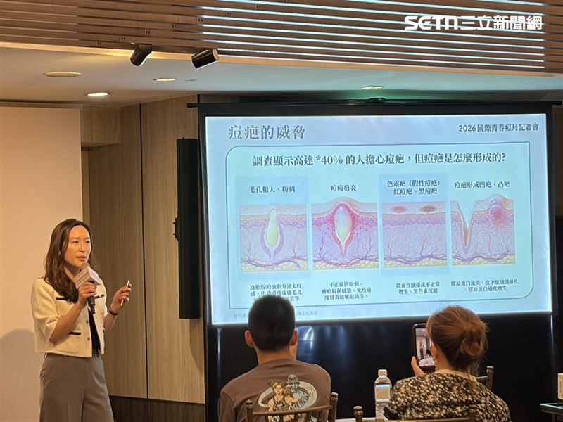 王筱涵醫師表示，青春痘是一種慢性發炎，如果拖延治療或是沒有解決發炎的問題，將會使皮膚組織受損。（圖／記者簡浩正攝影）