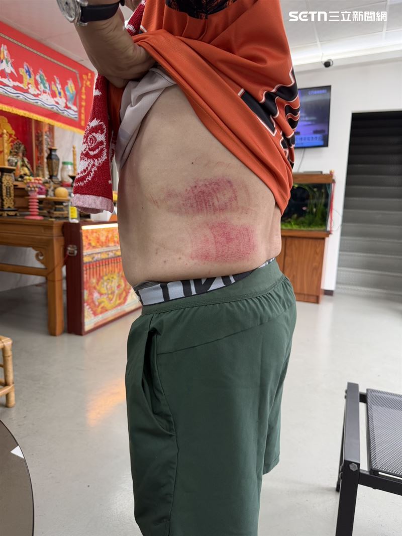 台南市議員郭鴻儀踩空跌進箱涵，奮力爬出造成身上多處擦傷。（圖／記者徐士庭攝影）