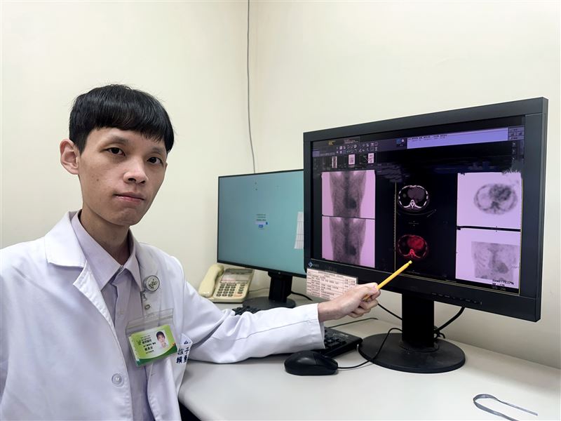 60多歲男子長年反覆喘、腫、覺得累，一直以為是老化或心衰竭，沒想到進一步檢測發現竟是罕見的「隱形心臟病」。(圖／署立豐原醫院提供)