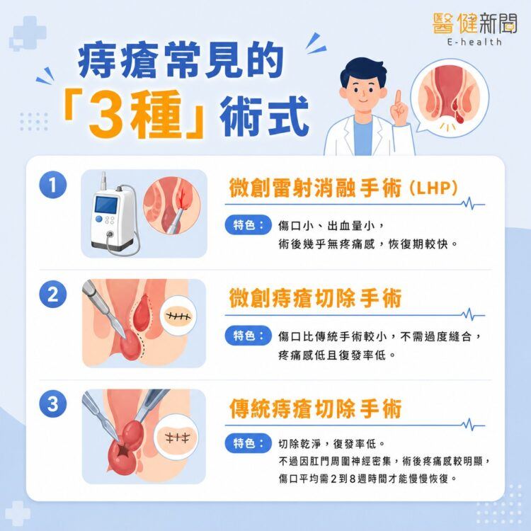 陳威智指出，如今醫療技術進步，若飽受痔瘡困擾，應盡快就醫，比起傳統的手術，現今微創痔瘡切除手術，傷口比傳統手術較小且復發率相對來說也很低。（圖／醫健新聞網提供）