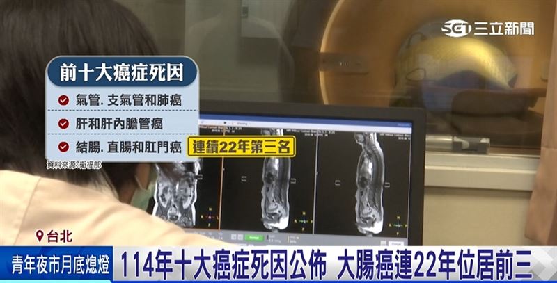 衛福部公布國人114年十大癌症順位，大腸癌連續22年位居前三名