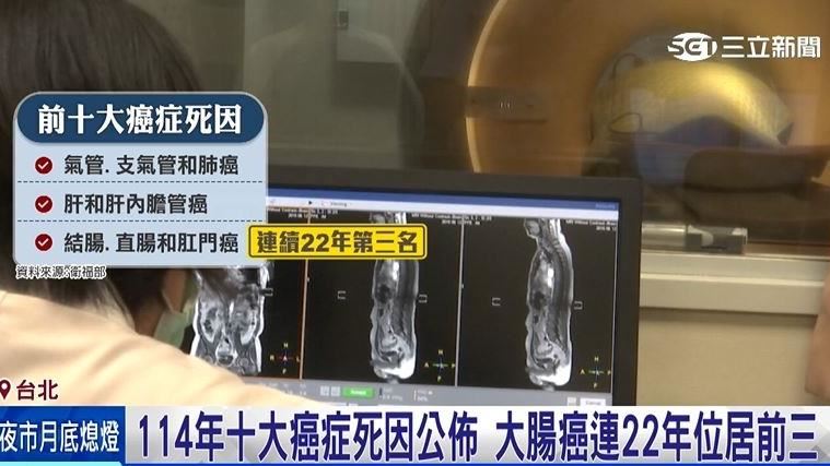 114年十大癌症死因 大腸癌連續22年居前三