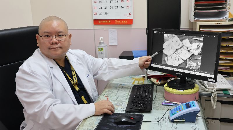 30多歲男子日前到泌尿科就診，醫師檢查後驚嚇，對方下體、下腹部，就連大腿內側都長滿菜花，共103顆菜花讓醫師清除到幾乎崩潰。（圖／中央社）