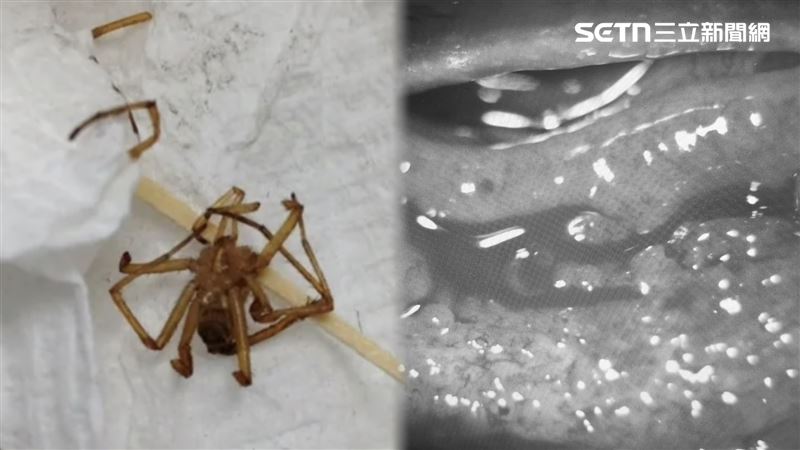 畫面曝!毒蛛2斷肢插眼球…櫃姐包屍求救