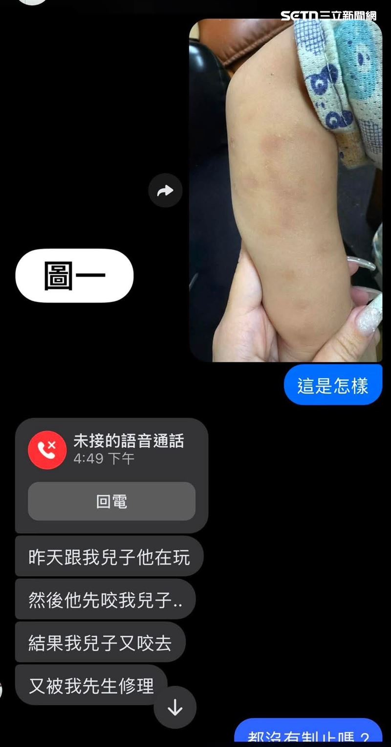 2歲大男童身上接連出現紅腫、瘀青傷痕。(圖/家長提供)