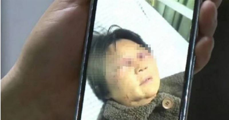 大陸浙江驚傳媳婦毆打婆婆的駭人事件,受害婆婆甚至被打斷4根肋骨。(圖/翻攝自微博/瀟湘晨報)