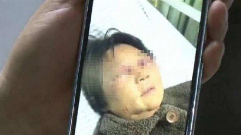 媳婦打斷婆婆肋骨 兒嗆「不帶孫就給錢」