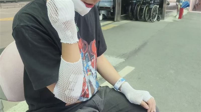 李男前往公園運動時遭3隻狗隻追咬受傷。(圖/民眾提供)