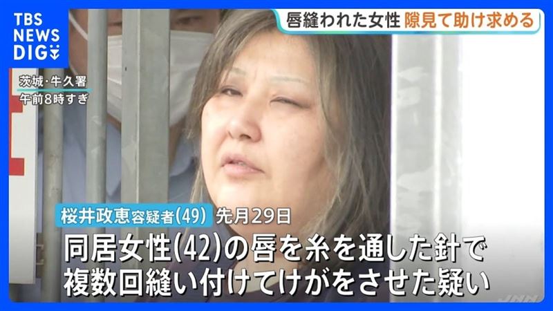49歲嫌犯櫻井政惠涉嫌持針線將同居女子的上下嘴唇縫合，導致對方無法開口說話。（圖／翻攝自TBS）