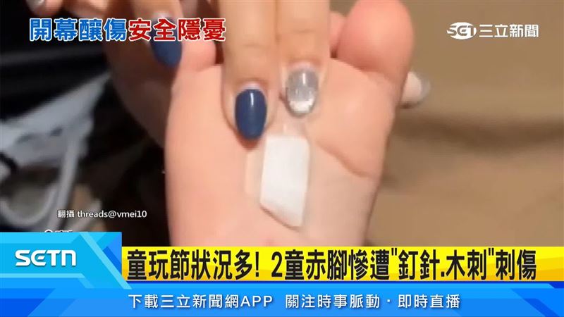 宜蘭童玩節剛開,就傳出一名男童在戲水池中被遺留的釘槍釘針刺傷