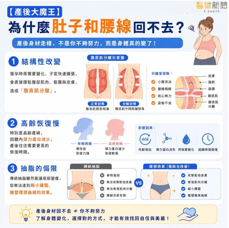 王冠穎表示,生產時胎兒會把腹直肌、筋膜和皮膚都撐鬆,使得產後腹部無法靠彈性自然縮回,而腹直肌分離也是同樣原理。(圖/醫健新聞網提供)