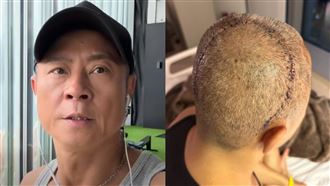 草蜢蔡一傑腦癌搶命　突宣布明年台北開唱