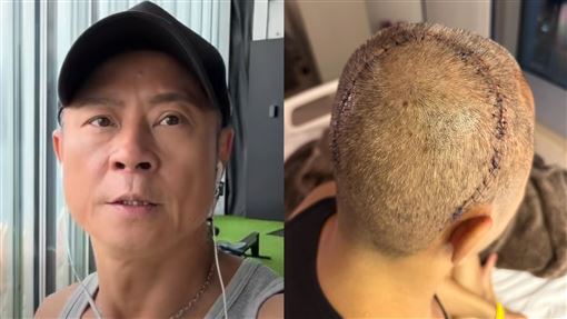 草蜢蔡一傑腦癌搶命　突宣布明年台北開唱