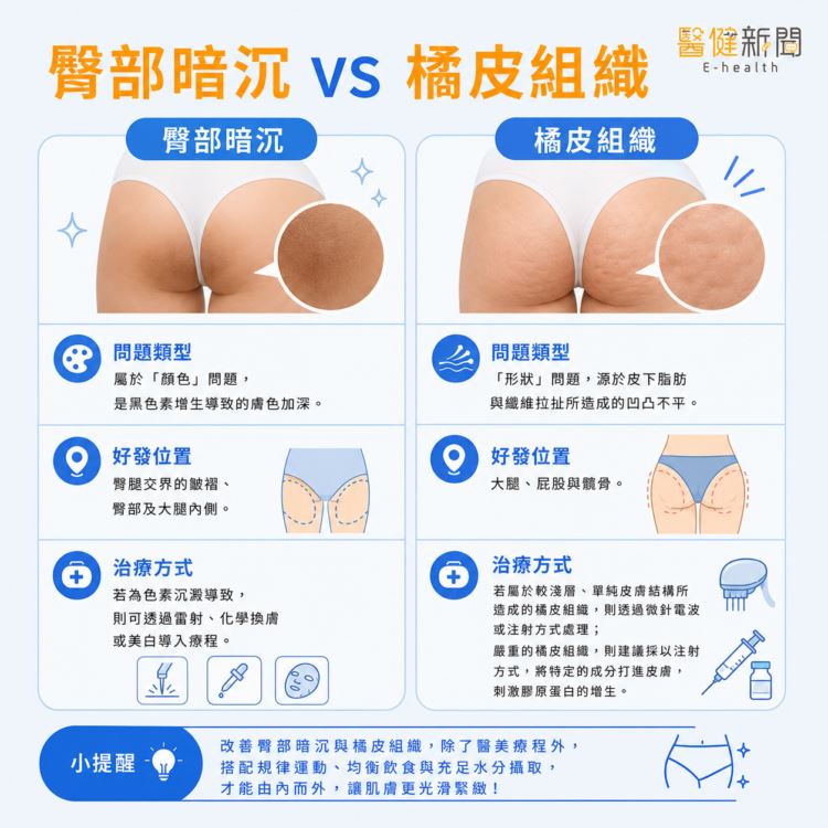 沈孟暵表示,橘皮是「形狀」問題,而臀部暗沉則屬於「顏色」問題,是黑色素增生導致的膚色加深。兩者連好發位置都不同,治療方式也不同。(圖/醫健新聞網提供)