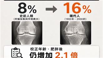變老變胖=膝蓋退化？真正兇手曝:大家都中