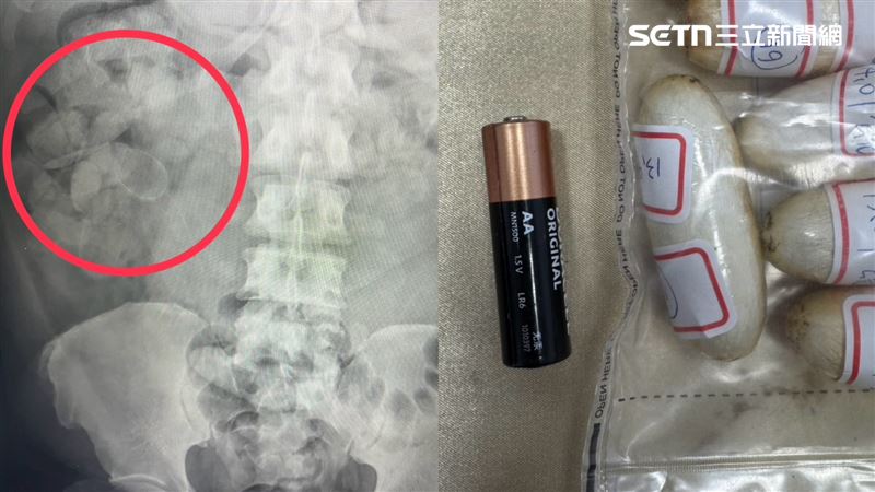 50歲法國籍男子,從泰國搭機入境桃園機場,經X光檢驗,赫然發現他的腸胃道內密密麻麻塞滿橢圓形異物,每顆都比3號電池還大。(圖/翻攝畫面)