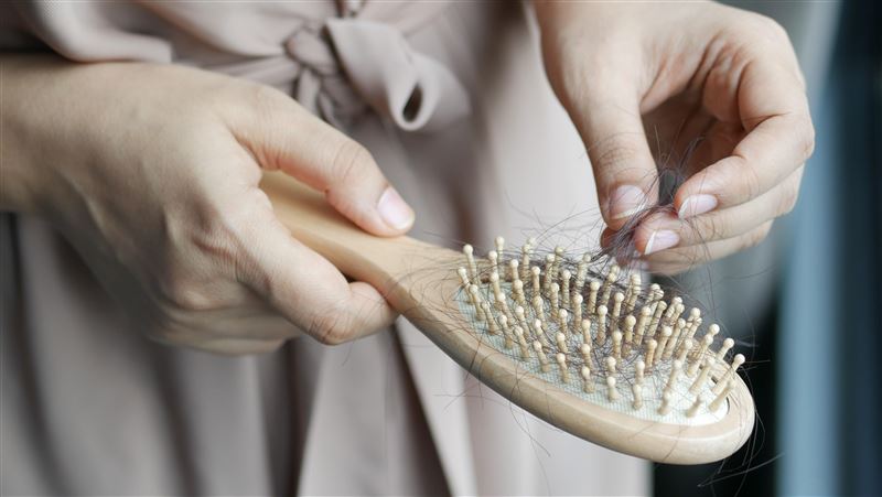 一名40歲女近日掉髮量大增，檢查後發現是鐵蛋白與維生素D不足。（示意圖／翻攝自Pexels）