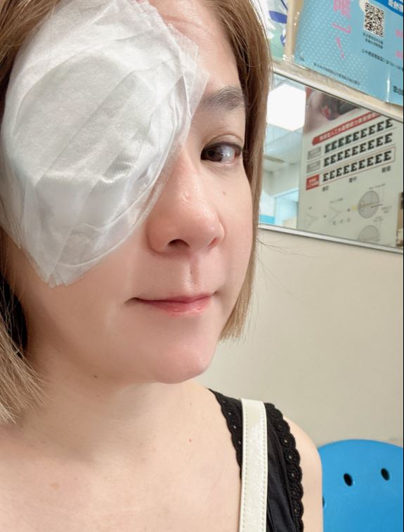 陸元琪透露,自己兩邊的眼睛都有不規則的白內障。(圖/翻攝自陸元琪臉書)