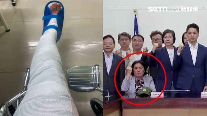 陳玉珍13日PO出腳受傷模樣,17日中午蔣萬安到國民黨團時,陳玉珍坐著輪椅到場,呼口號時表情被注意(組合圖/翻攝自陳玉珍臉書,翻攝畫面)