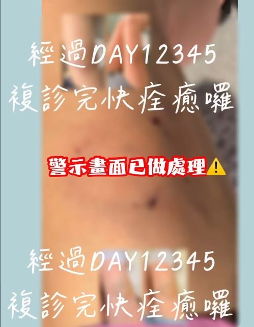 回憶事發經過,阿喜表示,當天是兩隻狗狗互動時發生衝突。(圖/翻攝自阿喜IG)
