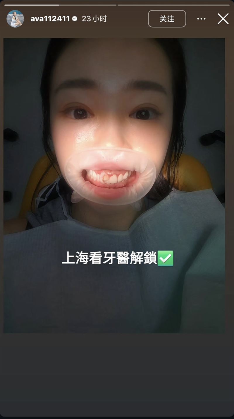丫頭在限時動態中,大方分享自己躺在牙醫診所診療椅上的畫面。(圖/翻攝自IG @ava112411)