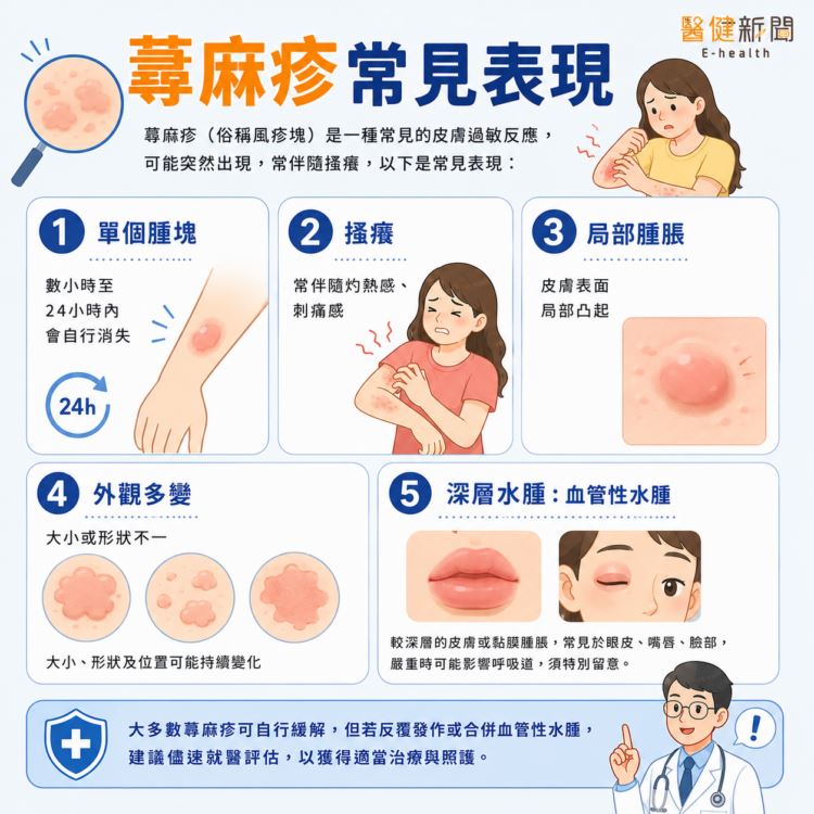 為什麼會有蕁麻疹?症狀有哪些?(圖/醫健新聞網提供)