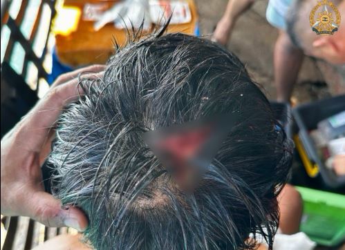 中國海警持木棍直接擊菲律賓海軍人員的頭部,造成該名官兵當場受傷。(圖/翻攝自菲律賓武裝部隊臉書臉書)