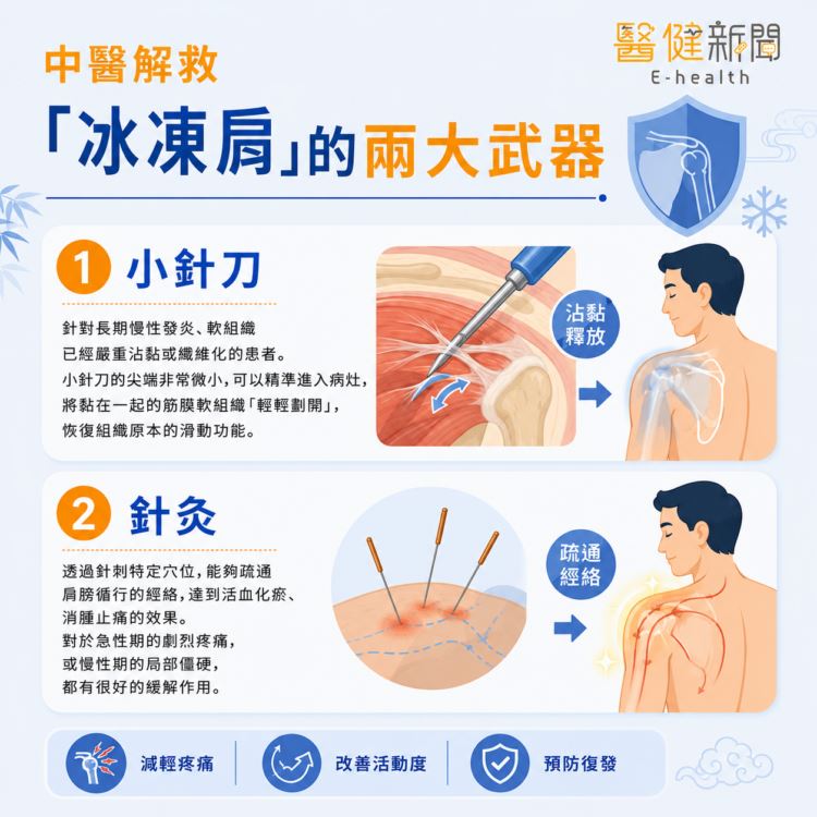 中醫解救「冰凍肩」的兩大武器。(圖/醫健新聞網提供)