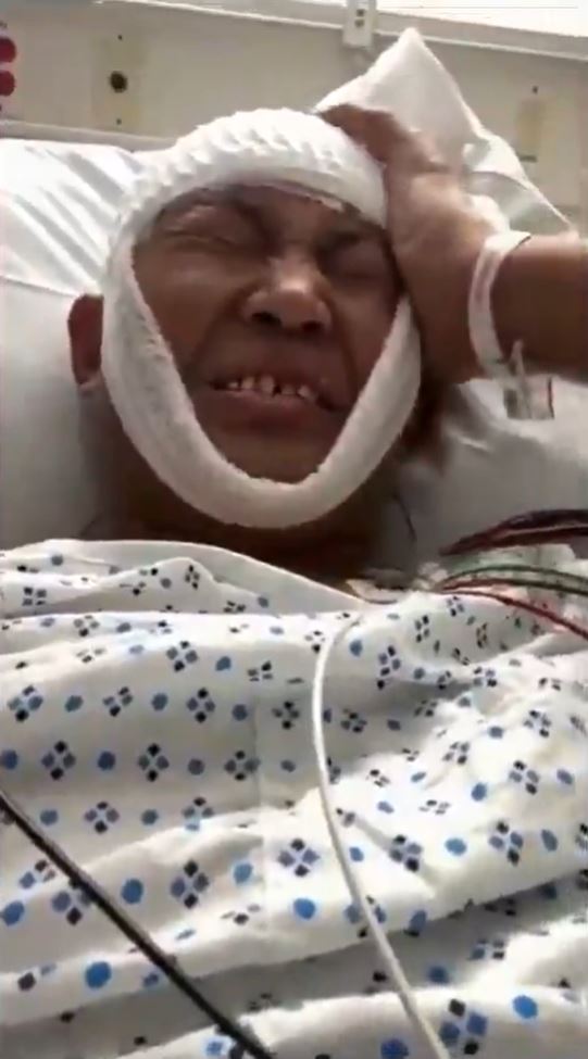 中國民主黨國際聯盟主席界立建於紐約遇襲，遭3名亞裔男子持棍痛毆導致頭部重創命危，引發外界對中共跨境鎮壓的強烈關注。（圖／翻攝自X平台）