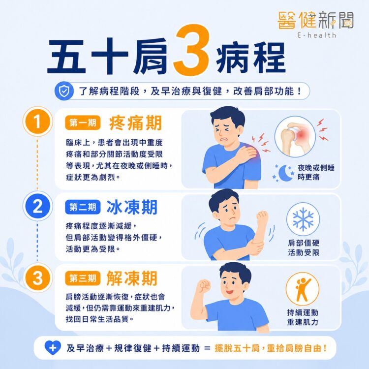 肩頸酸痛小心是五十肩！認識五十肩「三大病程」。（圖／醫健新聞網提供）