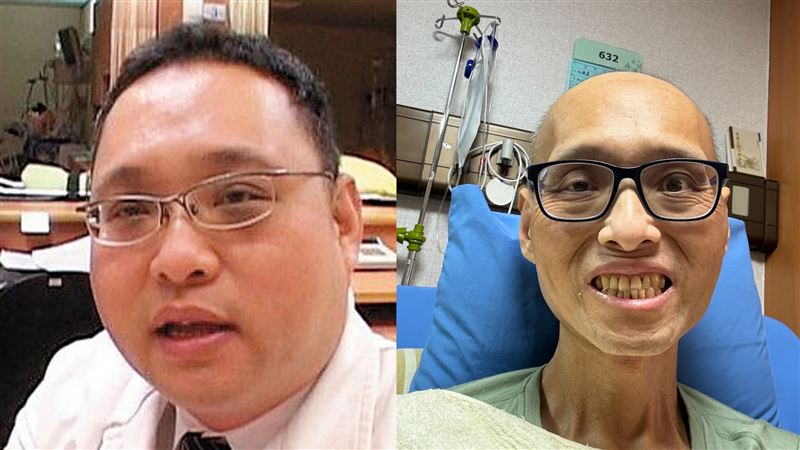 江咏霖醫師曾經生活萎靡,胖到120公斤,接連大病後爆瘦,如今體重控制在56公斤左右。(圖/受訪者提供)