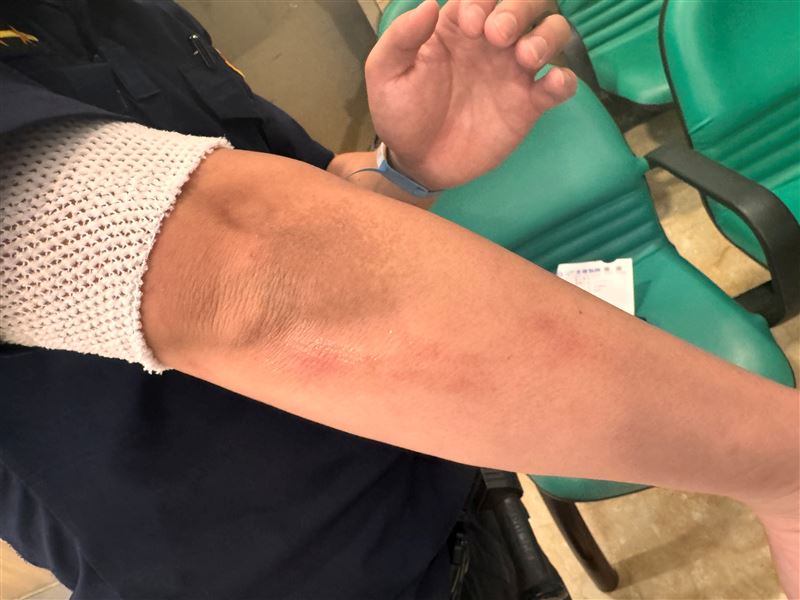 遭毆員警多處擦挫傷。(圖/翻攝畫面)