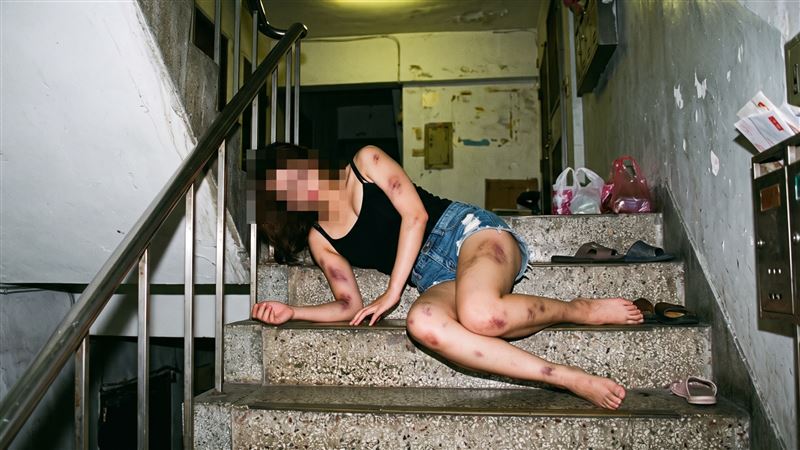 單親媽媽渾身傷倒地「兒無親可依」急安置