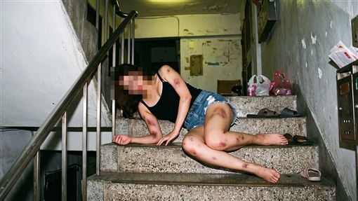 單親媽媽渾身傷倒地「兒無親可依」急安置