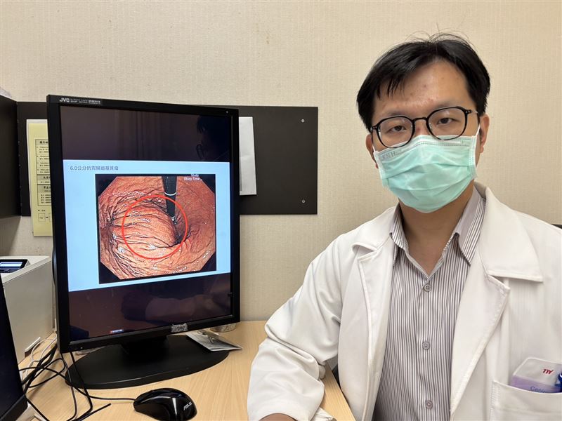 醫師表示，胃腸道基質瘤是發生在腸胃道黏膜下層或肌肉層，目前已知發生原因可能是基因突變，與胃癌常見誘發因素無關聯，沒有明確的致病原因。（圖／書田診所提供）
