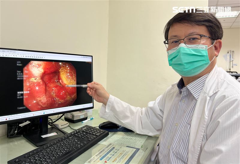 該菌主要經由口腔傳染,民眾平時若習慣「共食」不公筷母匙,或是使用開放式共用醬料,都極可能增加交叉感染的風險。(圖/翻攝畫面)