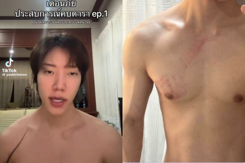 Yuki控訴遭到前男友家暴。（圖／翻攝自TikTok）