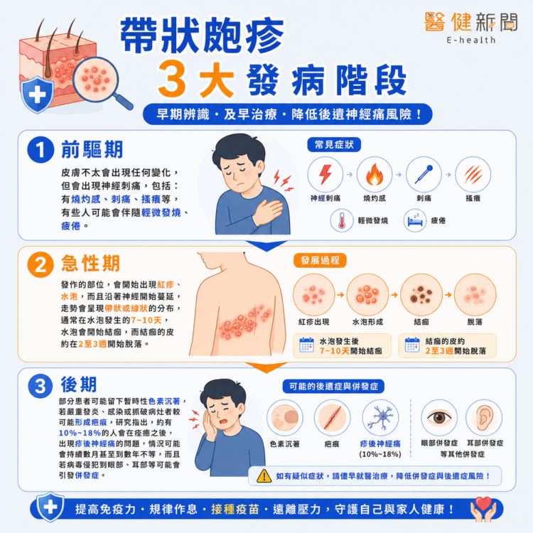 羅貽豪表示,帶狀皰疹會出現在身體的任何位置,並且會在該處形成刺痛或灼熱感,並且持續幾天,外觀會出現與水痘皮疹相似的紅疹,有些人甚至會出現發燒、發癢。(圖/醫健新聞網提供)