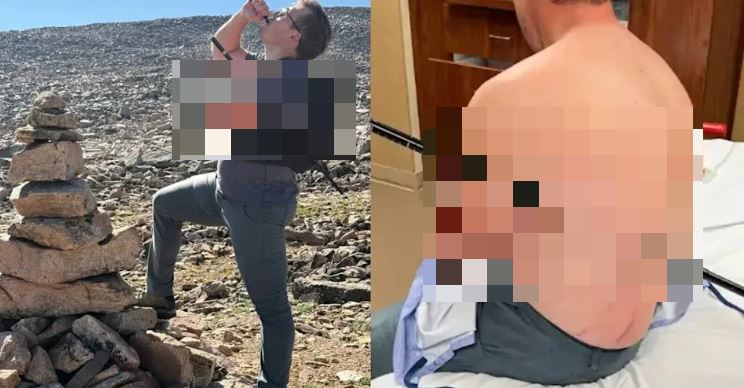 美國一名護理師遭登山杖貫穿軀幹。(圖/美聯社/達志影像)