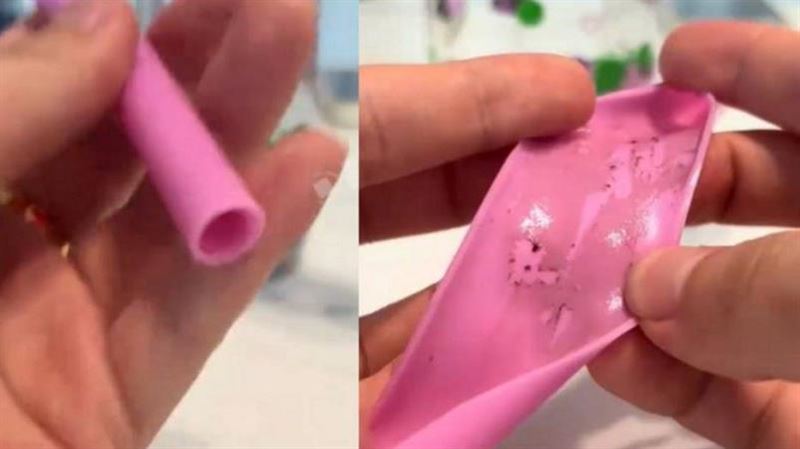 女長期狂拉肚子　慣用吸管內壁見驚人黑垢