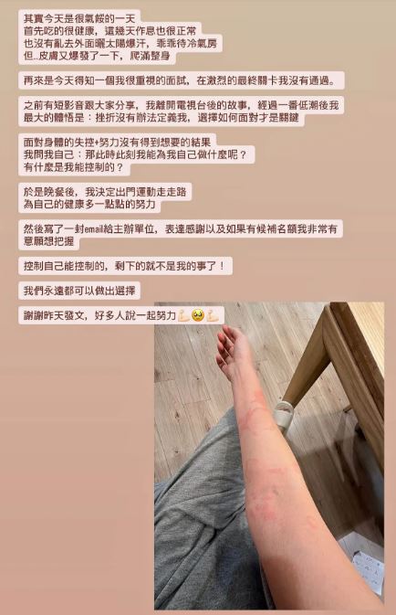優格姐姐6月底因突發性蕁麻疹併發血管性水腫，一度引發過敏性休克陷入昏迷，在鬼門關前走了一遭，如今蕁麻疹再度發作，讓她心情有些失落。（圖／翻攝自優格姐姐臉書）