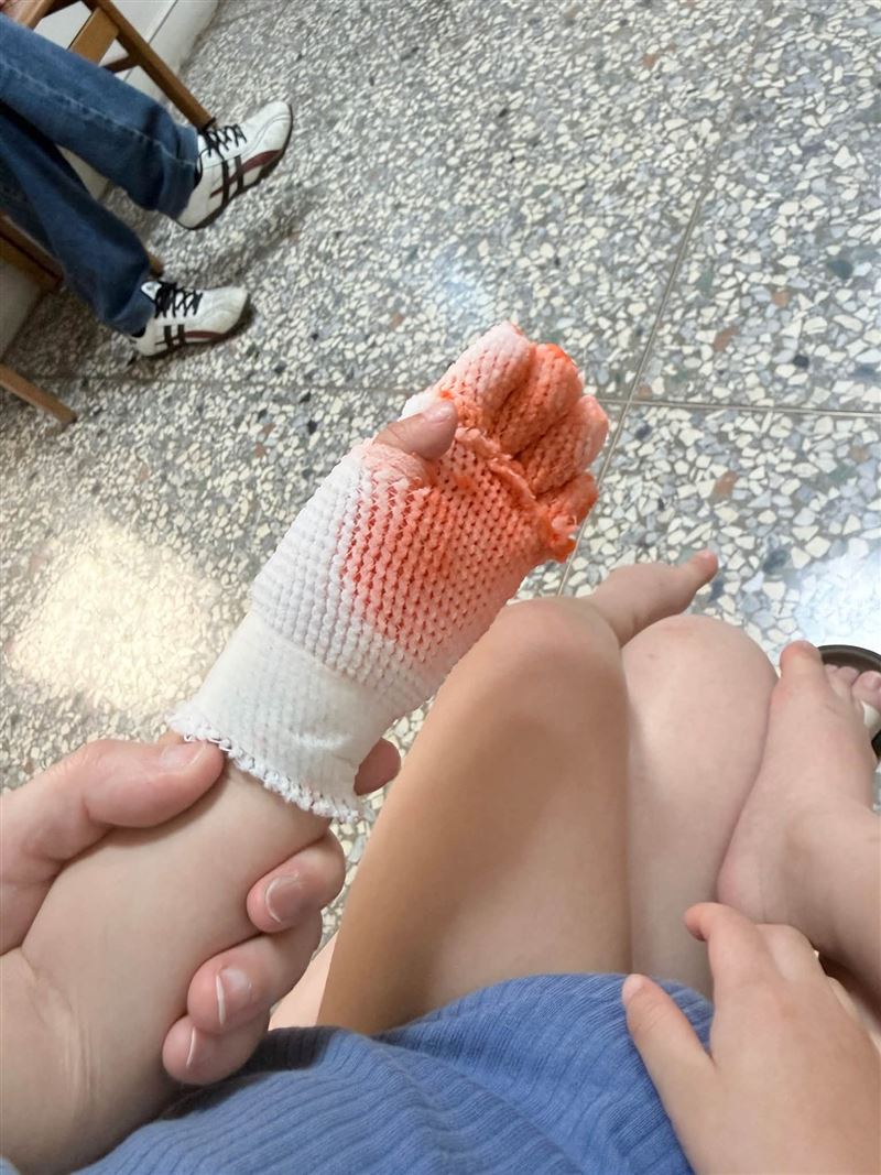 男童只是跌倒，沒想到立刻手被燙出大水泡。（圖／員林人大小事）