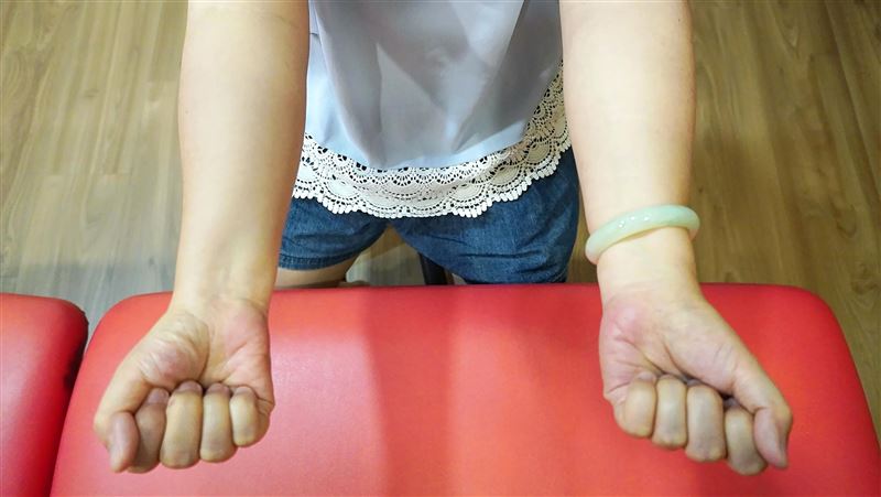 乳癌術後腫成「大象手」?醫:恐1惡疾前兆