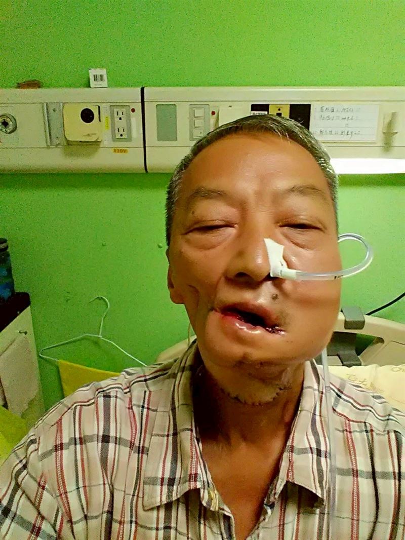 維國大哥罹患口腔癌第四期,術後改變外貌、與味覺。(圖/陽光基金會提供)