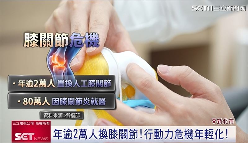 關節危機！醫籲完整配方才有關鍵守護力
